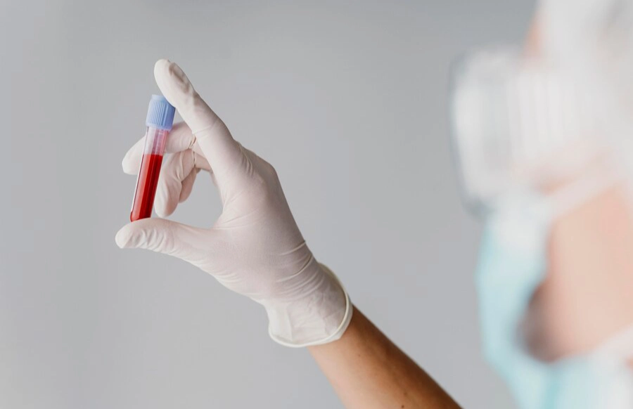 blood tests in dubai